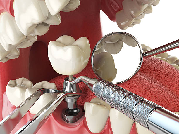 Best Mobile Emergency Dentist in Buchanan, MI