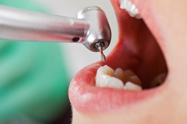 Best Emergency Dental Services for Seniors in Buchanan, MI